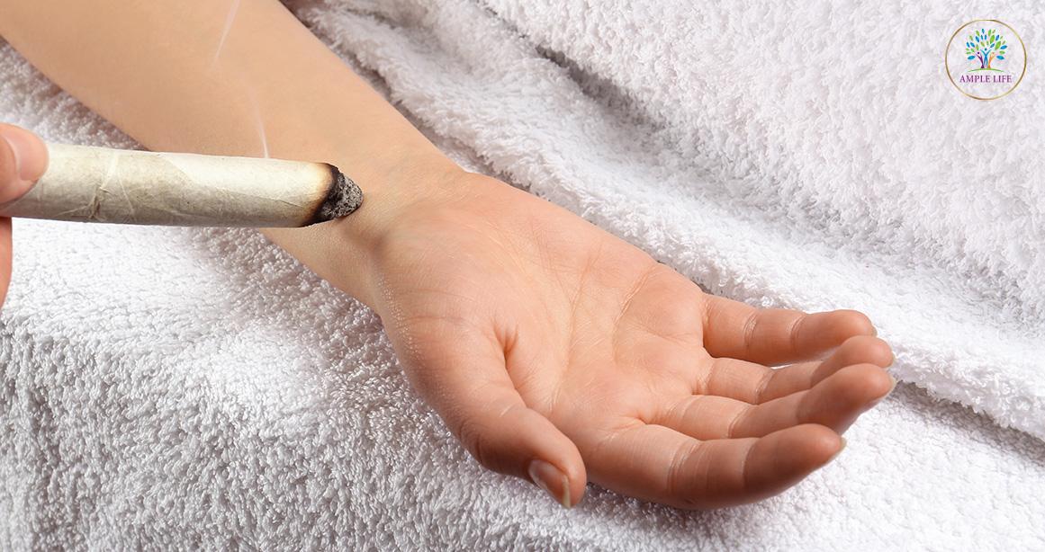 Your One-Stop Guide To Moxibustion & Its Health Benefits
