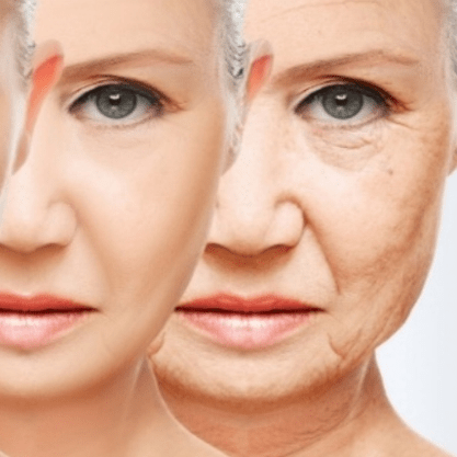 Skin- Time Reset